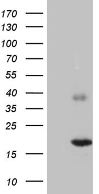C5orf56 Antibody (clone OTI4B11)