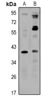 SLC30A8 / ZNT8 Antibody