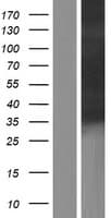 SDR / SDPR Protein (Over-Expression Lysate Myc-DDK (Flag))
