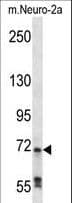 IHC-plus™ RAF1 / RAF Antibody (aa86-113)