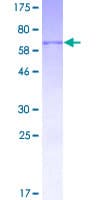Human HSD3B1 Protein (Recombinant GST)