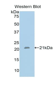SHH / Sonic Hedgehog Antibody (aa28-192)