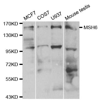 Polyclonal Rabbit anti-Human MSH6 Antibody (IHC, IF, WB)