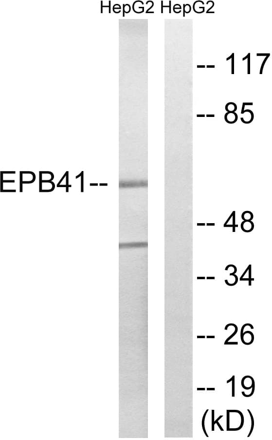Band 4.1 / EPB41 Antibody (aa626-675)