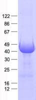 Human HDAC8 Protein (Recombinant His, N-Terminal)