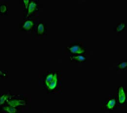 Polyclonal Rabbit anti-Human KDM1A / LSD1 Antibody (IHC, IF, WB)