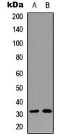 RPS6 / Ribosomal Protein S6 Antibody (C-Terminus)