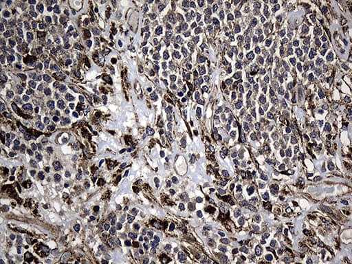 AFAP1 / AFAP Antibody (clone OTI2A3)