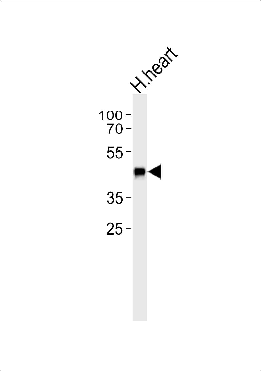 Polyclonal Rabbit anti-Human SLC29A1 / ENT1 Antibody (aa402-431, IHC, WB)