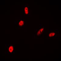 Histone H2B Antibody (N-Terminus)