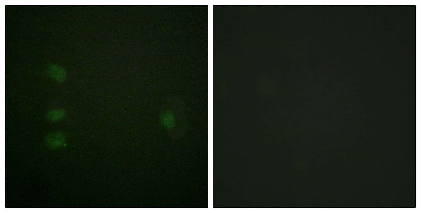 NPM1 / NPM / Nucleophosmin Antibody (aa171-220)