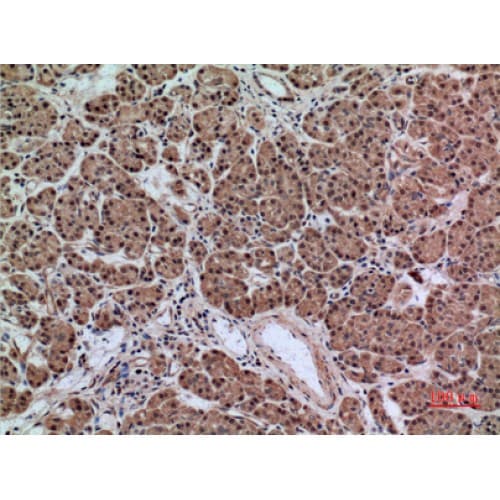 Alpha-1-Antichymotrypsin Antibody (251-300 aa, Internal)