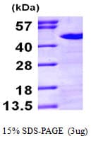 Human NCK1 / NCK Protein (Recombinant His)