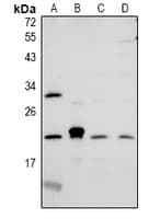 Polyclonal Rabbit anti-Human CMTM6 / CKLFSF6 Antibody (WB)