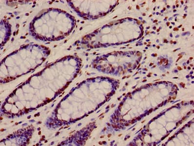 HIST1H4I Antibody