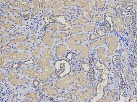 EIF5A Antibody