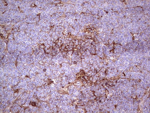 APOE / Apolipoprotein E Antibody (clone OTI1H6)