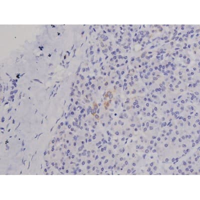 FAK / Focal Adhesion Kinase Antibody (phospho-Tyr576)