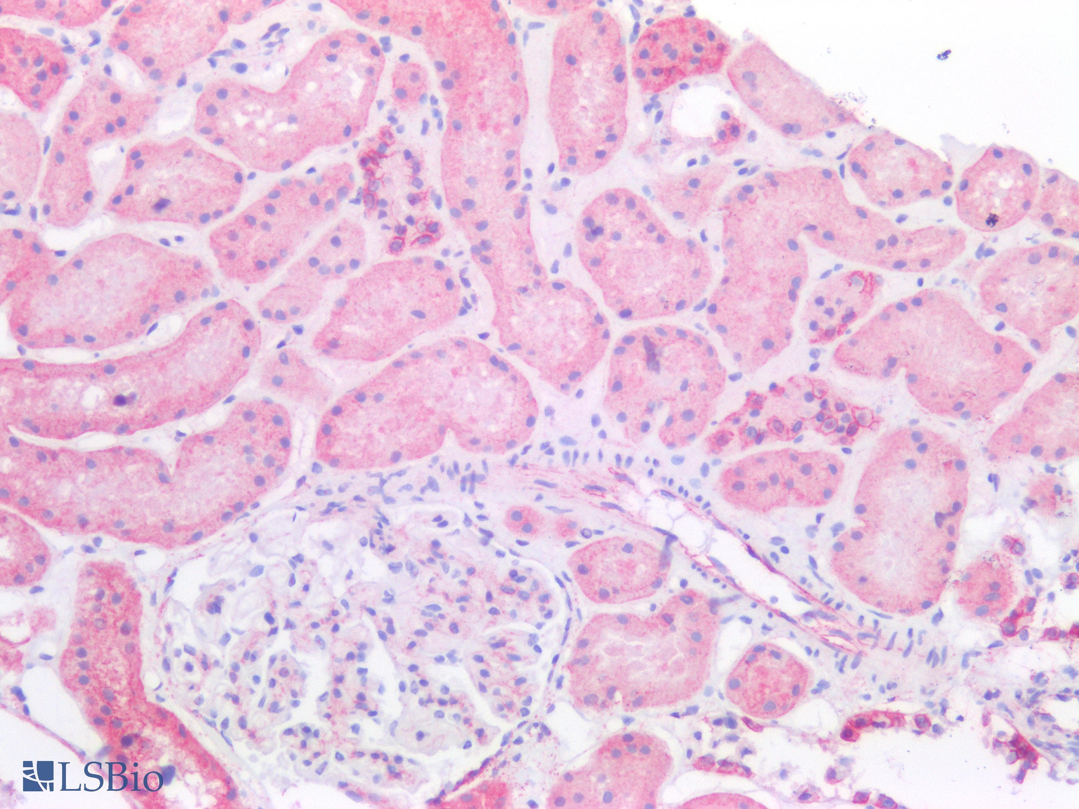 PathPlus™ CTNNB1 / Beta Catenin Antibody (C-Terminus)