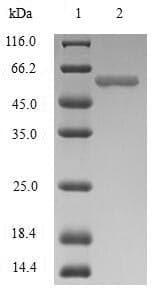 Human JCHAIN / Ig J Chain Protein (Recombinant MBP, N-terminus + 6His, C-terminus)