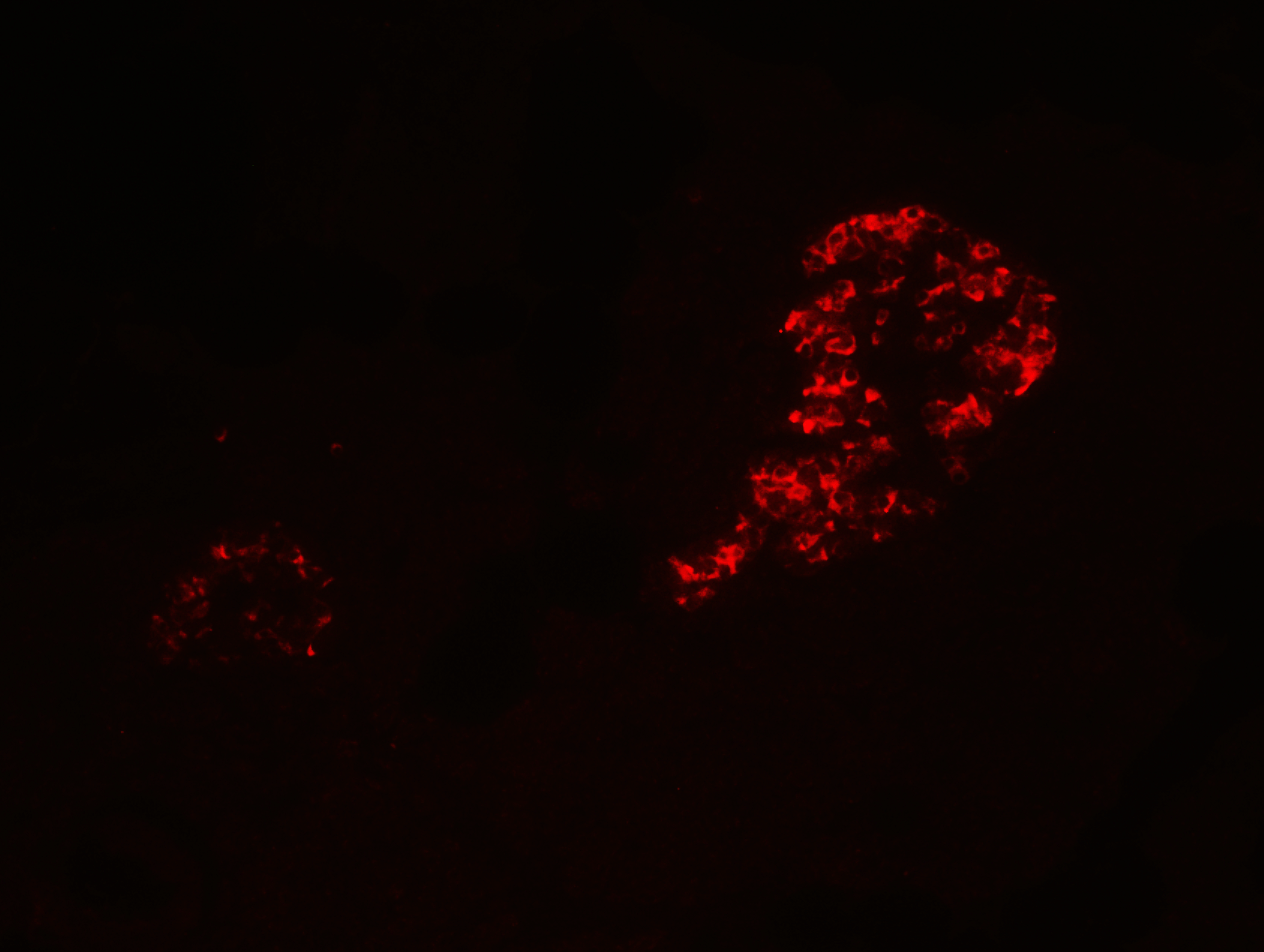 IHC-plus™ IL12A / p35 Antibody