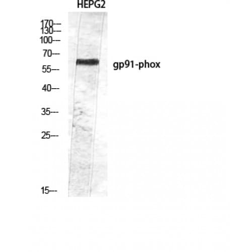 Polyclonal Rabbit anti-Human CYBB / NOX2 / gp91phox Antibody (Internal, IHC, WB)