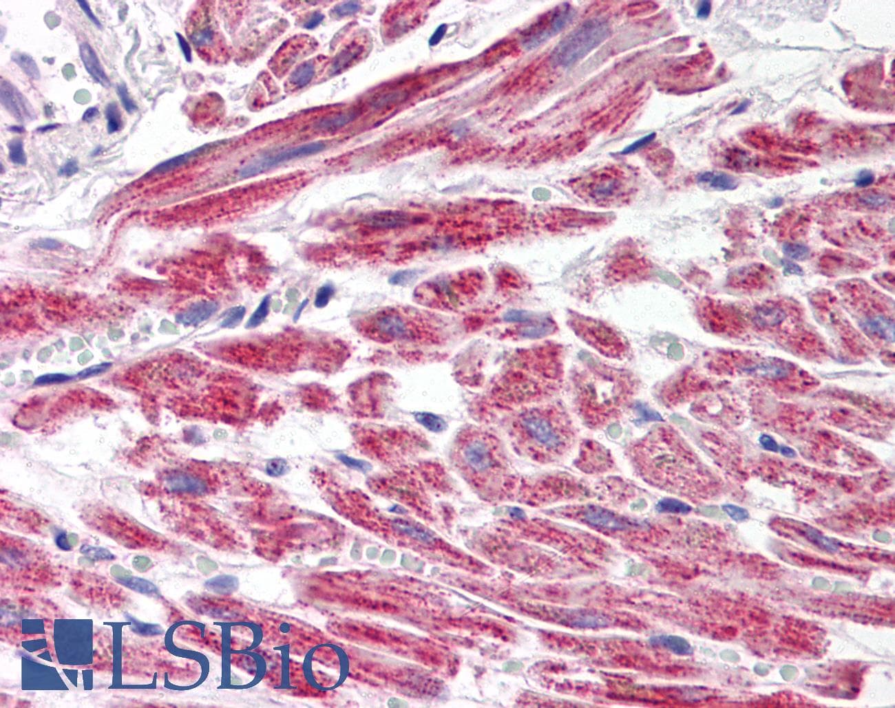 IHC-plus™ SNAI2 / SLUG Antibody