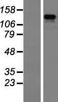 ZBED4 Protein (Over-Expression Lysate Myc-DDK (Flag))
