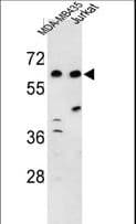 C19orf26 Antibody (aa423-450)