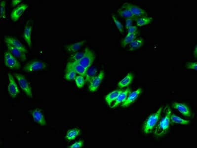 PLLP / Plasmolipin Antibody