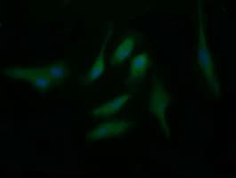 BBOX1 / BBOX Antibody (clone OTI4F9)