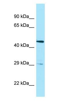 HTRA3 Antibody (aa188-237)