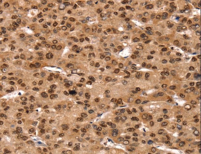 Polyclonal Rabbit anti-Human TAF10 Antibody (IHC, WB)