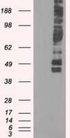 SLC2A5 / GLUT5 Antibody (clone OTI2C4)