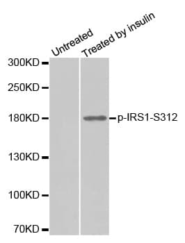IRS1 Antibody (phospho-Ser312)