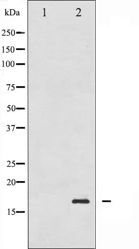 Polyclonal Rabbit anti-Human Histone H3.1 Antibody (phospho-Ser10, IHC, WB)