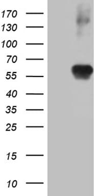 Monoclonal Mouse anti-Human RING1 Antibody (clone OTI11G7, aa88-362, IHC, WB)