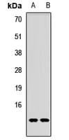 TP53AIP1 / p53 AIP1 Antibody