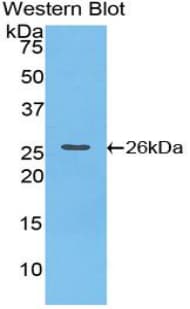 CTF1 / Cardiotrophin-1 Antibody (aa1-203, Cy3)