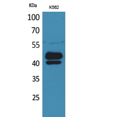 Polyclonal Rabbit anti-Human PSG1 / CD66f Antibody (221-270 aa, Internal, WB)