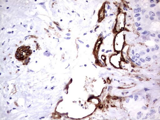 MCAM / CD146 Antibody (clone UMAB154)