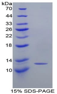 Mouse CCL2 / MCP1 Protein (Recombinant His)