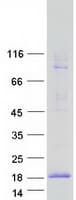 Human FXYD3 Protein (Recombinant Myc-DDK (Flag))