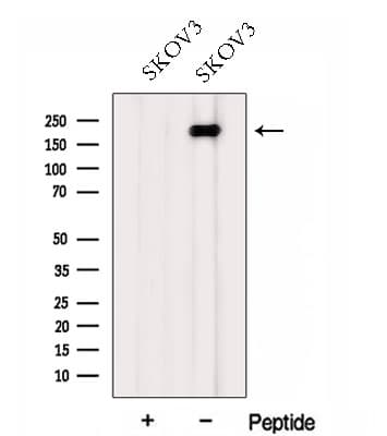 Polyclonal Rabbit anti-Human FMN2 / Formin 2 Antibody (WB)