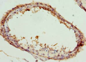 Polyclonal Rabbit anti-Human CCT5 / TCP1 Epsilon Antibody (IHC, WB)