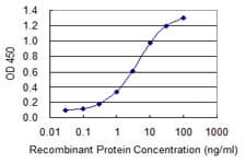 GCAP2 / GUCA1B Antibody (clone 5E7)