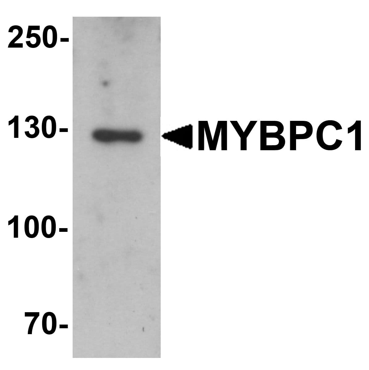Polyclonal Rabbit anti-Human MYBPC1 Antibody (IF, WB)