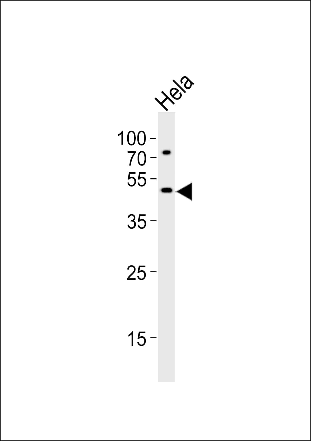 VPS4A Antibody (aa44-77)