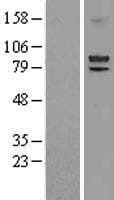 LOXL2 Protein (Over-Expression Lysate Myc-DDK (Flag))