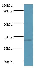 RNF212 Antibody (aa1-297)